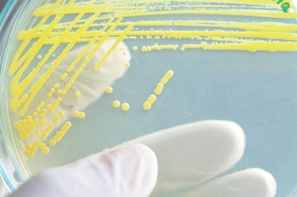 How to keep produce safe from salmonella, other hazards